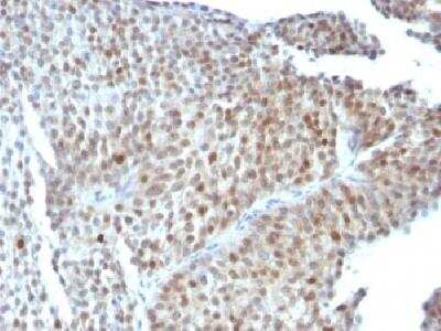 Immunohistochemistry-Paraffin: p53 Antibody (SPM589) [NBP2-32891]