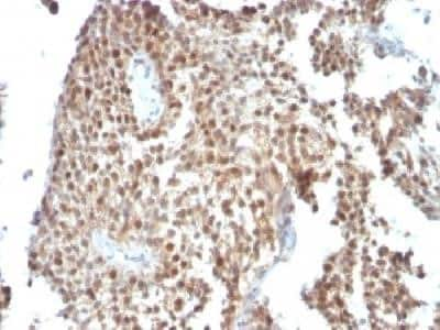 Immunohistochemistry-Paraffin: p53 Antibody (SPM590) - Azide and BSA Free [NBP2-34434]