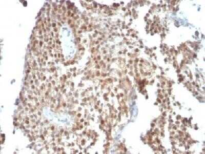 Immunohistochemistry-Paraffin: p53 Antibody (SPM590) - IHC-Prediluted [NBP2-44979]