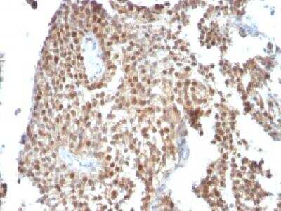 Immunohistochemistry-Paraffin: p53 Antibody (SPM590) [NBP2-34387]