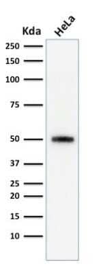 Western Blot: p53 Antibody (SPM590) [NBP2-34387]