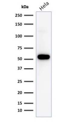 Western Blot: p53 Antibody (TP53/1799R)Azide and BSA Free [NBP2-59632]