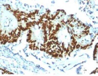 Immunohistochemistry-Paraffin: p53 Antibody (TP53/1799R) [NBP2-59631]