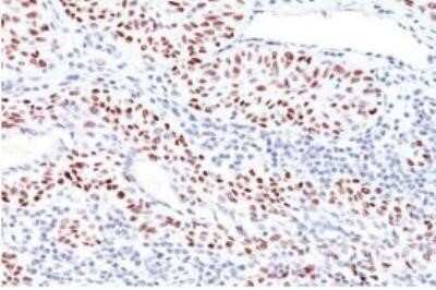 Immunohistochemistry-Paraffin: p53 Antibody (TRP/816) - Azide and BSA Free [NBP2-59628]