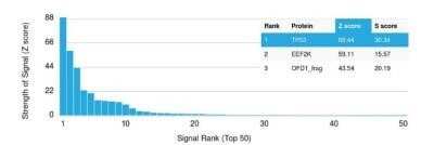 Protein Array: p53 Antibody (TRP/816) - Azide and BSA Free [NBP2-59628]