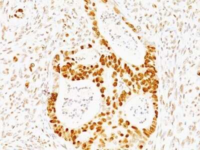 Immunohistochemistry-Paraffin: p53 Antibody (TRP/817) [NBP2-44982]