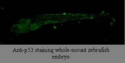 Immunohistochemistry: p53 Antibody (V5P4H6*B3) - BSA Free [NBP2-50231]