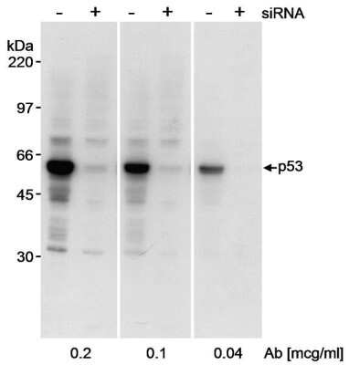 Western Blot: p53 Antibody [NB200-171]