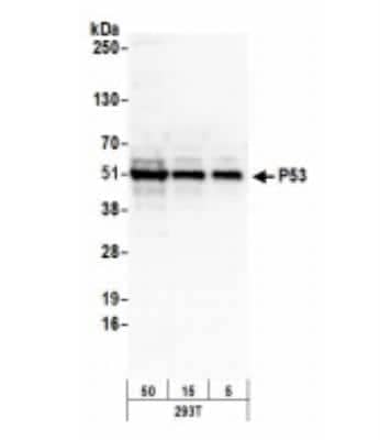 Western Blot: p53 Antibody [NB200-171]