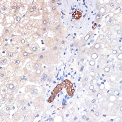 Immunohistochemistry-Paraffin: p53 DINP1 Antibody (9Y6Z7) [NBP3-16620]