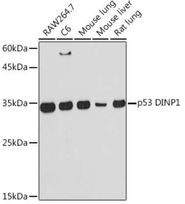 Western Blot: p53 DINP1 Antibody (9Y6Z7) [NBP3-16620]