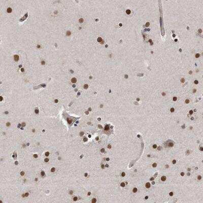 Immunohistochemistry-Paraffin: p53 DINP1 Antibody [NBP1-85108]