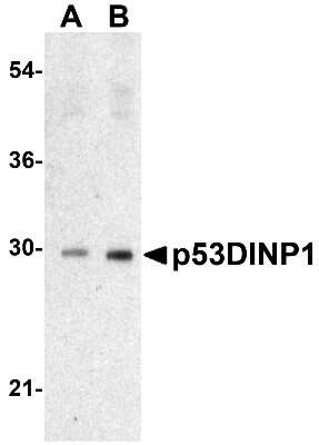 Western Blot: p53 DINP1 AntibodyBSA Free [NBP1-76638]