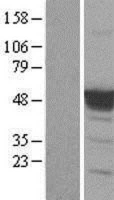 Western Blot: p53 Overexpression Lysate [NBL1-17203]