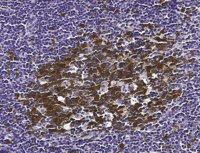 Immunohistochemistry-Paraffin: p53R2 Antibody (001) [NBP2-90185]