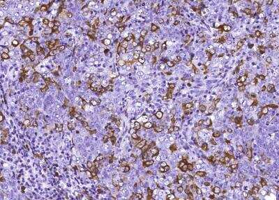 Immunohistochemistry-Paraffin: p53R2 Antibody (001) [NBP2-90185]
