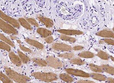 Immunohistochemistry-Paraffin: p53R2 Antibody (001) [NBP2-90185]