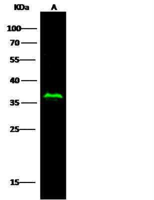 Western Blot: p53R2 Antibody (074) [NBP2-90186]