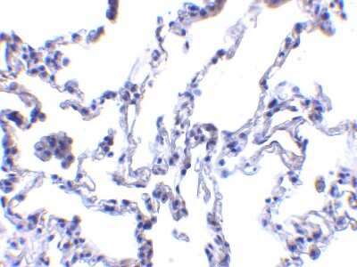Immunohistochemistry-Paraffin: p53R2 Antibody - BSA Free [NBP1-76781]