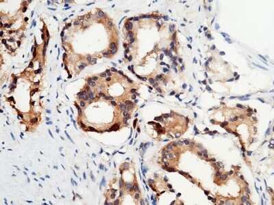 Immunohistochemistry-Paraffin: p53R2 Antibody [NBP3-00079]
