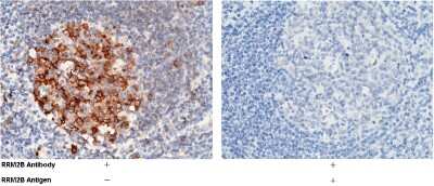 Immunohistochemistry-Paraffin: p53R2 Antibody [NBP3-00079]