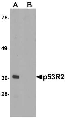 Western Blot: p53R2 AntibodyBSA Free [NBP1-76781]