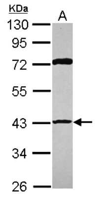 Western Blot: p53R2 Antibody [NBP2-19668]