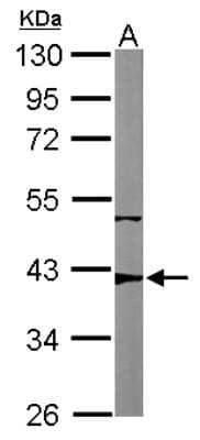 Western Blot: p53R2 Antibody [NBP2-19668]