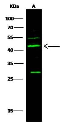 Western Blot: p53R2 Antibody [NBP3-00079]