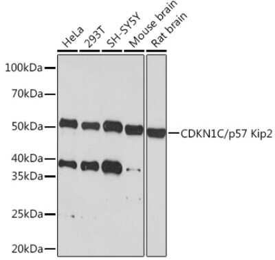 Western Blot: p57 Kip2 Antibody (6T4E6) [NBP3-16648]