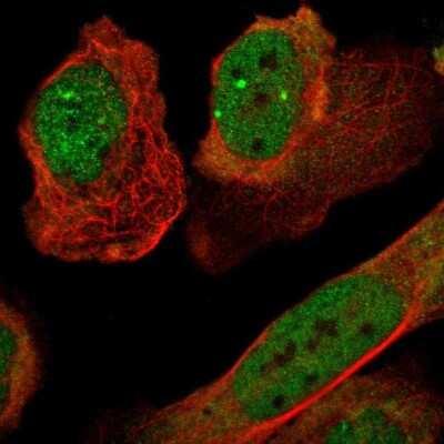 Immunocytochemistry/ Immunofluorescence: p57 Kip2 Antibody [NBP1-89917]