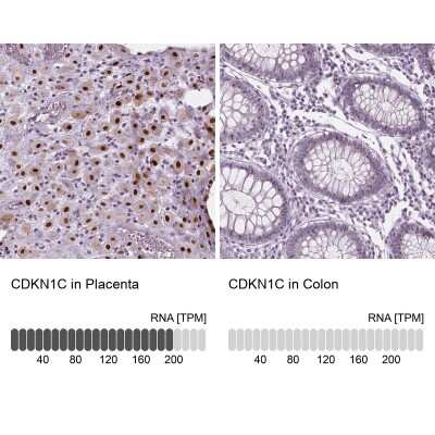 Immunohistochemistry-Paraffin: p57 Kip2 Antibody [NBP1-89917]