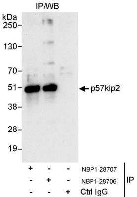 Immunoprecipitation: p57 Kip2 Antibody [NBP1-28707]