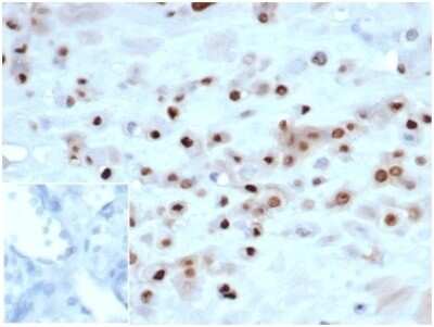 Immunohistochemistry-Paraffin: p57 Kip2 Antibody (KIP2/7083R) [NBP3-13832]