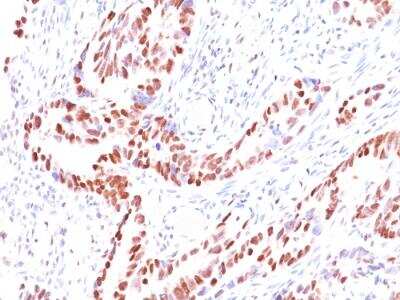 Immunohistochemistry-Paraffin: p57 Kip2 Antibody (KIP2/880) - IHC-Prediluted [NBP2-48133]
