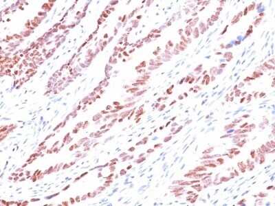 Immunohistochemistry-Paraffin: p57 Kip2 Antibody (KP10) - Azide and BSA Free [NBP2-47764]