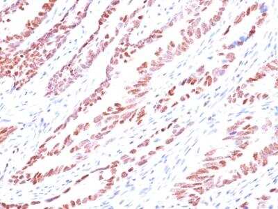 Immunohistochemistry-Paraffin: p57 Kip2 Antibody (KP10) - IHC-Prediluted [NBP2-48411]