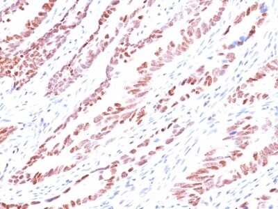 Immunohistochemistry-Paraffin: p57 Kip2 Antibody (KP10) [NBP2-44488]