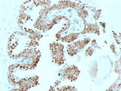 Immunohistochemistry-Paraffin: p57 Kip2 Antibody (SPM308) - Azide and BSA Free [NBP2-47765]