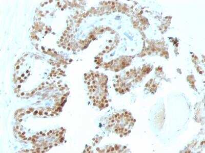 Immunohistochemistry-Paraffin: p57 Kip2 Antibody (SPM308) - IHC-Prediluted [NBP2-48424]