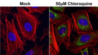 Immunocytochemistry/ Immunofluorescence: p62/SQSTM1 Antibody (1478) [NBP2-43663]