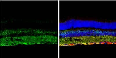 Immunohistochemistry-Frozen: p62/SQSTM1 Antibody (1478) [NBP2-43663]