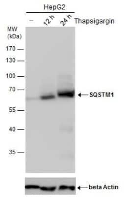Western Blot: p62/SQSTM1 Antibody (1478) [NBP2-43663]
