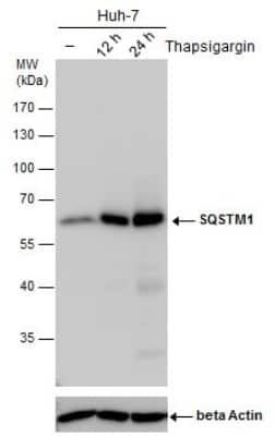Western Blot: p62/SQSTM1 Antibody (1478) [NBP2-43663]