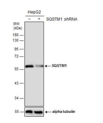 Western Blot: p62/SQSTM1 Antibody (1478) [NBP2-43663]