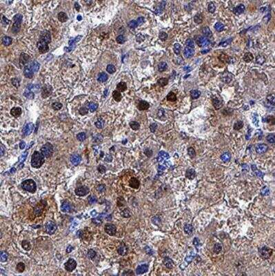 Immunohistochemistry-Paraffin: p62/SQSTM1 Antibody (2533B) - BSA Free [NBP2-92995]