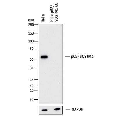 Knockout Validated: p62/SQSTM1 Antibody (2533B) - BSA Free [NBP2-92995]