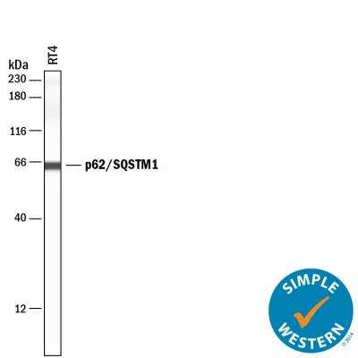 Simple Western: p62/SQSTM1 Antibody (2533B)BSA Free [NBP2-92995]