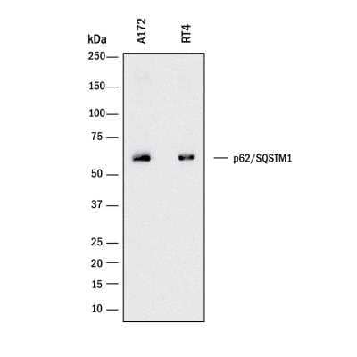 Western Blot: p62/SQSTM1 Antibody (2533B)BSA Free [NBP2-92995]