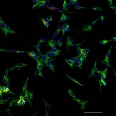 Immunocytochemistry/ Immunofluorescence: p62/SQSTM1 Antibody (2C11) [H00008878-M01]
